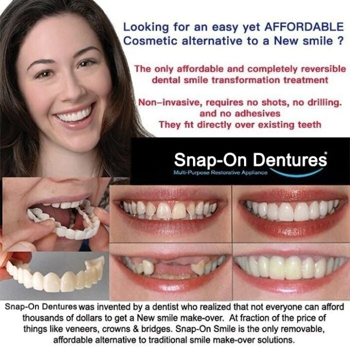 Mother's Day Sale-49% OFF🔥Adjustable Snap-On Dentures  For All Tooth Shapes